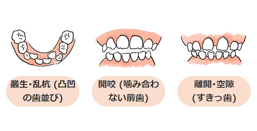 矯正歯科